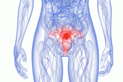 Рак матки симптомы и признаки при климаксе