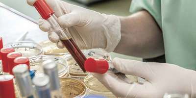 Новый анализ крови для выявления рака