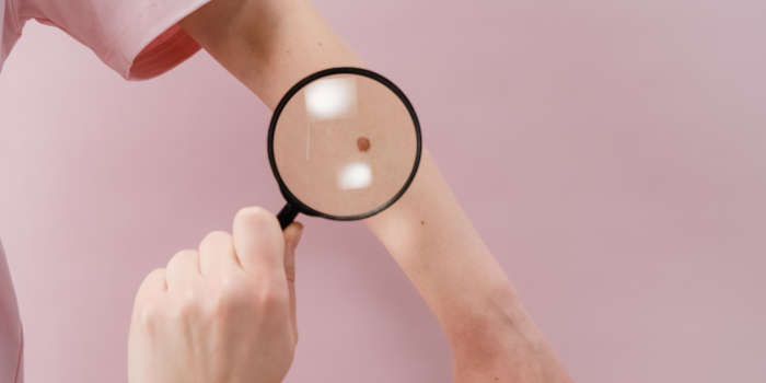 Новый прибор для диагностики рака кожи и меланомы
