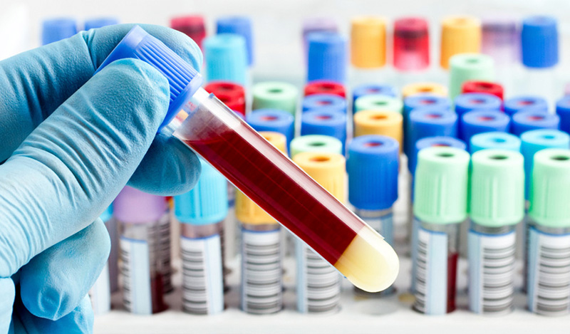 анализ-крови-стентирование