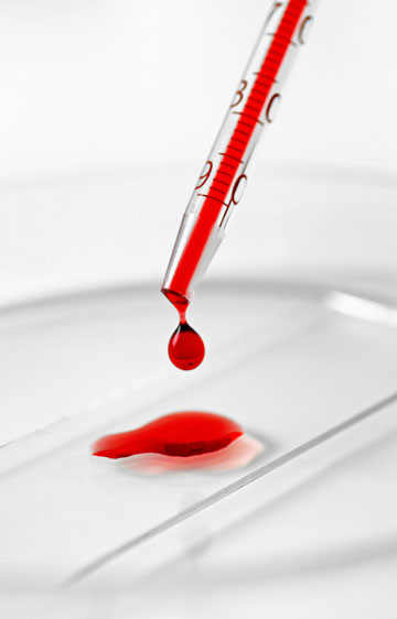 biopsiya-kostei-pic4