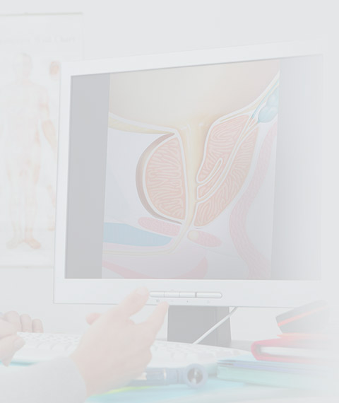 Биопсия предстательной железы цена в Москве, записаться на биопсию ...