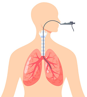 Исследование легких: методы диагностики заболеваний дыхательной системы