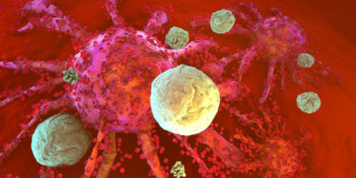 iNKT клетки против рака