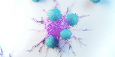 Терапия CAR-T-клетками: эффективное дополнение к хирургическому лечению рака