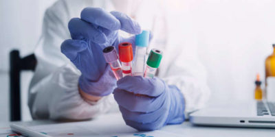 Ученые оценили точность нового анализа крови для скрининга рака кишечника